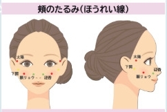 頬のたるみ・ほうれい線に効くツボの位置