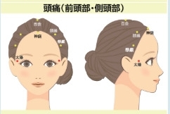 頭痛・頭の重さに効くツボ